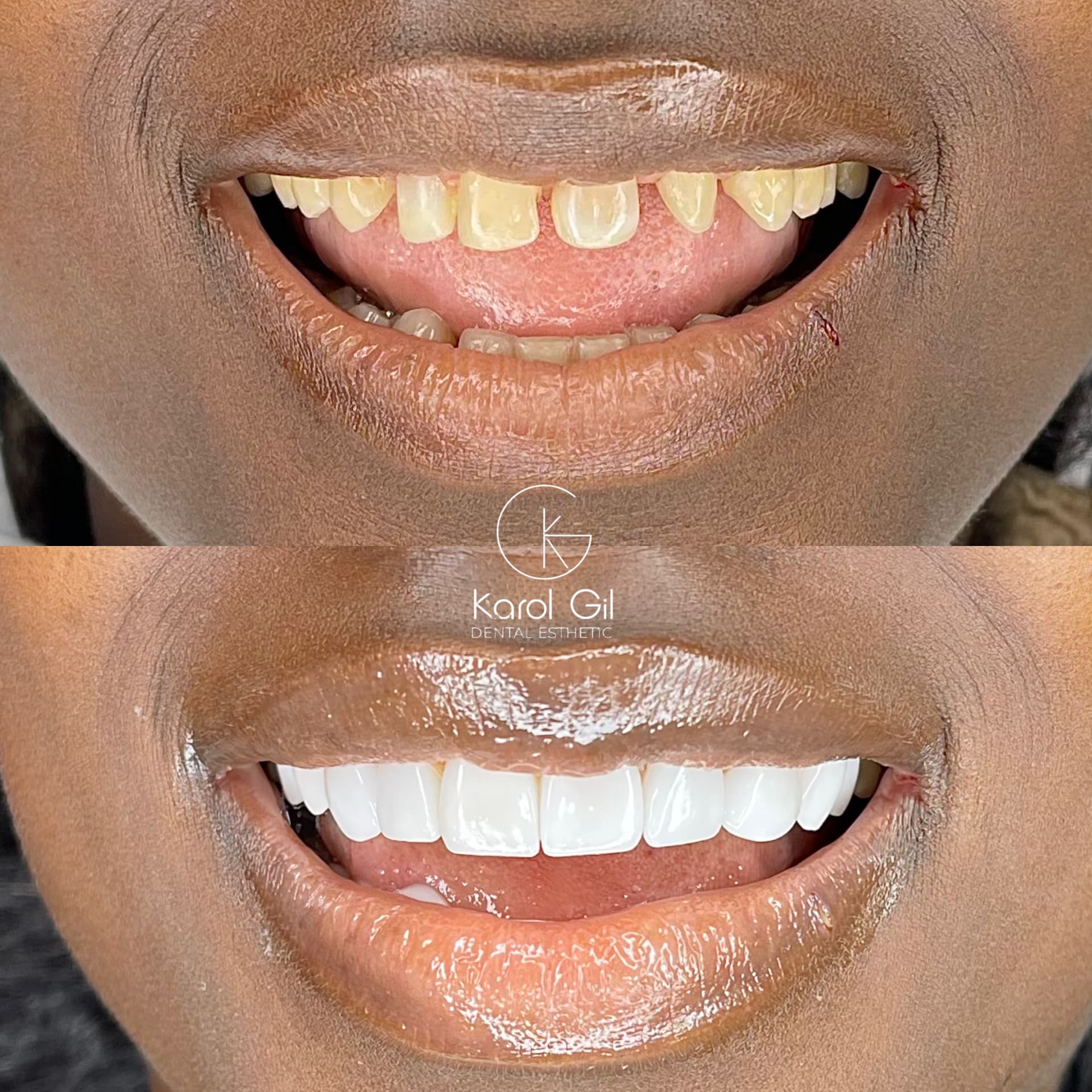 Real patient before and after treatment, case 3